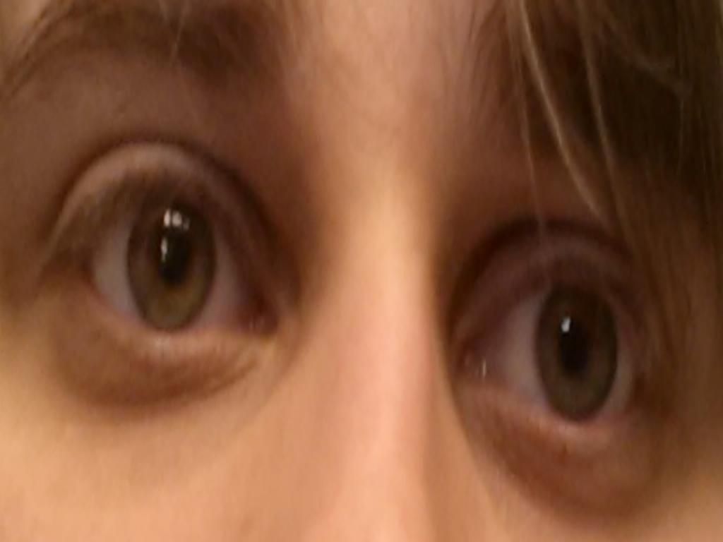 [PokeCommunity.com] Today I learned I am slowly going blind.